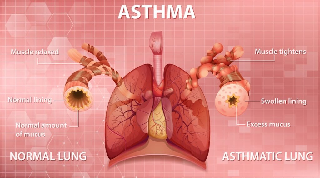 Lung Function Test in Vasundhara Ghaziabad.