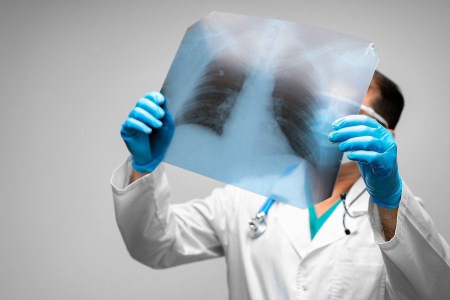 best fungal pneumonia treatment doctor in Vasundhara Sector 1.