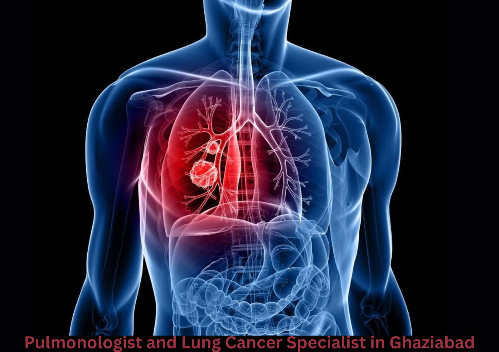 Best Pulmonologist and Lung Cancer Specialist in Ghaziabad